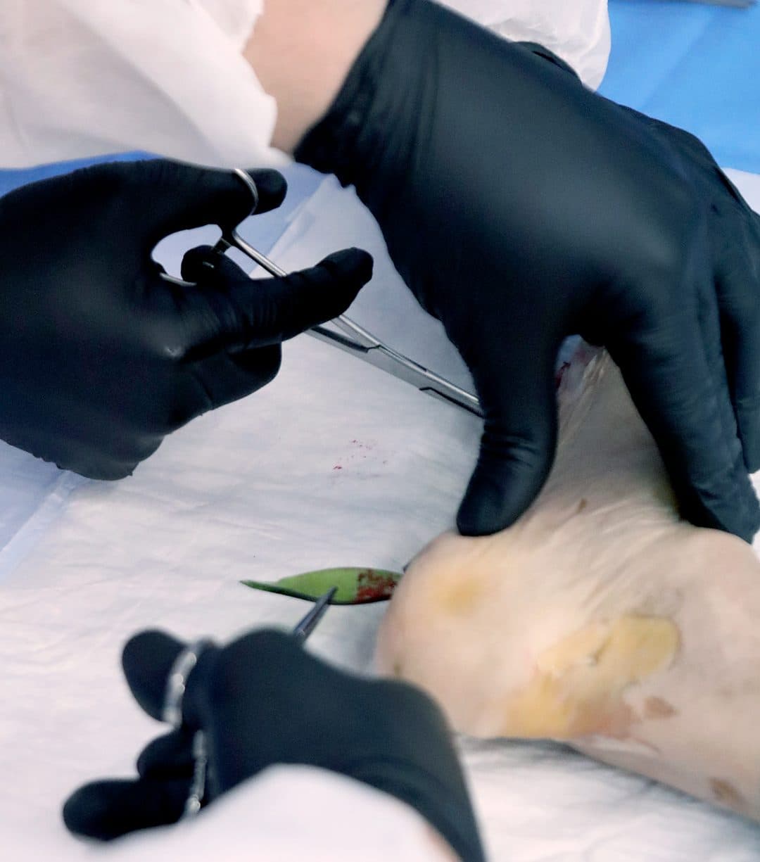 Mãos com luvas suturando o tecido durante a prática